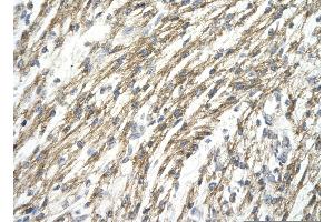 Immunohistochemistry (IHC) image for anti-Hypoxia Inducible Factor 1, alpha Subunit (Basic Helix-Loop-Helix Transcription Factor) (HIF1A) (N-Term) antibody (ABIN2779347)