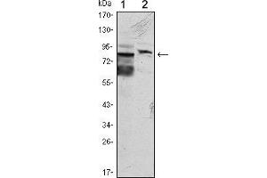 Western blot analysis using KLHL11 mouse mAb against Hela (1) and MCF-7 (2) cell lysate. (KLHL11 antibody)