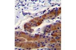 Formalin fixed and paraffin embedded stomach tissue reacted with Whirlin  Antibody  followed by peroxidase conjugation of the secondary antibody and DAB staining. (DFNB31 antibody  (Middle Region))