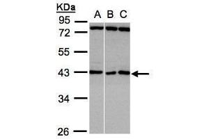 WB Image Sample(30 ug whole cell lysate) A:A431, B:HeLa S3, C:Hep G2 , 10% SDS PAGE antibody diluted at 1:1000 (ASB5 antibody)