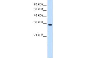 Western Blotting (WB) image for anti-Transient Receptor Potential Cation Channel, Subfamily M, Member 5 (TRPM5) antibody (ABIN2461116) (TRPM5 antibody)