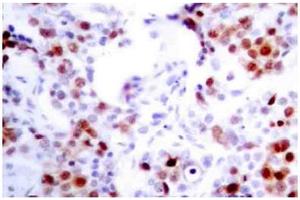 Image no. 1 for anti-Activating Transcription Factor 2 (ATF2) antibody (ABIN265319) (ATF2 antibody)