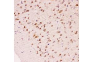Immunohistochemistry (IHC) image for anti-Apurinic/Apyrimidinic Endonuclease 1 (APEX1) (AA 2-318) antibody (ABIN3043785)