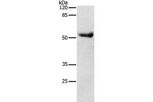 Western Blot analysis of Human liver cancer tissue using DRD4 Polyclonal Antibody at dilution of 1:600 (DRD4 antibody)