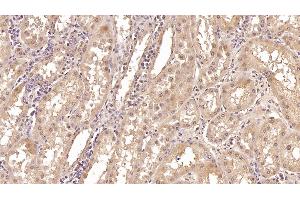 Detection of CRYl1 in Human Kidney Tissue using Monoclonal Antibody to Crystallin Lambda 1 (CRYl1)