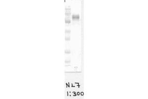 Image no. 1 for anti-Cytochrome B-245, beta Polypeptide (CYBB) antibody (ABIN1042598) (CYBB antibody)