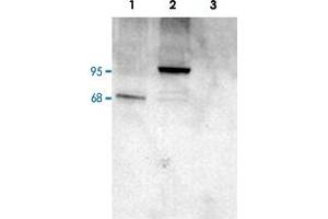 PDE4D polyclonal antibody  staining (1 ug/mL) of COS cell lysates (25 ug protein) : transfected with human PDE4D1 (1), transfected with human PDE4D3 (2), untransfected (3). (PDE4D antibody  (C-Term))