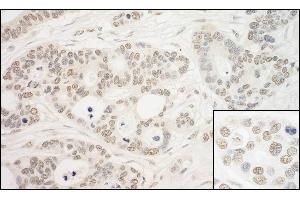anti-PRP6 Pre-mRNA Processing Factor 6 Homolog (PRPF6) (AA 1-50) antibody