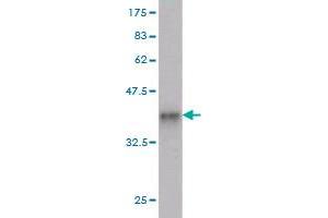 Western Blot detection against Immunogen (36. (PDPK1 antibody  (AA 253-348))