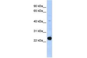 Image no. 1 for anti-Chromosome 16 Open Reading Frame 80 (C16orf80) (AA 71-120) antibody (ABIN6740375) (C16orf80 antibody  (AA 71-120))