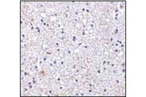Immunohistochemistry of SCO1 in human brain tissue with this product at 2.