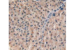 IHC-P analysis of Human Liver Tissue, with DAB staining. (CHI3L1 antibody  (AA 112-377))