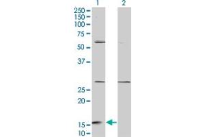 Western Blot analysis of GHRL expression in transfected 293T cell line by GHRL monoclonal antibody (M08), clone 3B8. (Ghrelin antibody  (AA 1-117))