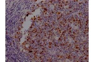 Immunohistochemistry (IHC) image for anti-Aurora Kinase B (AURKB) antibody (ABIN7127357)