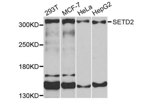 SETD2 抗体  (AA 803-1103)