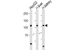 Western blot analysis of lysates from HepG2 cell line, human liver, human kidney tissue (from left to right), using MTTP Antibody (C-term) (ABIN6242904 and ABIN6577849). (MTTP antibody  (C-Term))