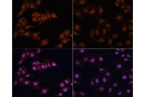 Immunofluorescence analysis of HeLa cells using MAP1LC3B antibody (ABIN6291773) at dilution of 1:100.