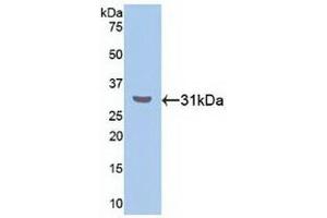 Western blot analysis of recombinant Human RORa. (RORA antibody  (AA 164-401))