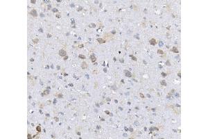 IHC analysis of Alkaline phosphatase/ALPL using anti-Alkaline phosphatase/ALPL antibody (ABIN7603162).