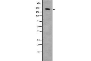 Western blot analysis of ARHGEF17 using K562 whole cell lysates (ARHGEF17 antibody  (C-Term))