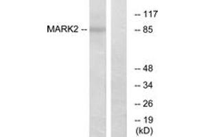 Western blot analysis of extracts from COS7 cells, using MARK2 Antibody. (MARK2 antibody  (AA 10-59))