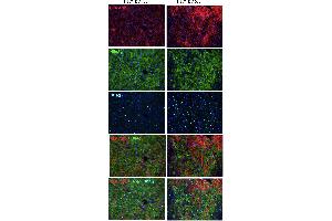 HLA-ABC antibody