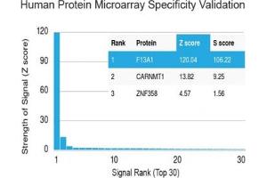 Analysis of HuProt(TM) microarray containing more than 19,000 full-length human proteins using Factor XIIIa antibody (clone F13A1/1448). (F13A1 antibody  (AA 46-181))