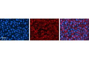 ASAHL antibody - middle region          Formalin Fixed Paraffin Embedded Tissue:  Human Liver Tissue    Observed Staining:  Cytoplasm in lysosomes of hepatocytes   Primary Antibody Concentration:  1:100    Other Working Concentrations:  1/600    Secondary Antibody:  Donkey anti-Rabbit-Cy3    Secondary Antibody Concentration:  1:200    Magnification:  20X    Exposure Time:  0. (NAAA antibody  (Middle Region))