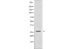 Western blot analysis of extracts from K562 cells, using TNFRSF9 antibody. (CD137 antibody  (Internal Region))