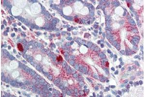 Human Small Intestine (formalin-fixed, paraffin-embedded) stained with MED4 antibody ABIN462248 followed by biotinylated goat anti-rabbit IgG secondary antibody ABIN481713, alkaline phosphatase-streptavidin and chromogen. (MED4 antibody  (AA 146-195))