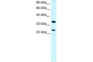 Western Blotting (WB) image for anti-Asialoglycoprotein Receptor 2 (ASGR2) antibody (ABIN2460819)