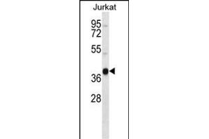 RCH4 Antibody (C-term) (ABIN657255 and ABIN2846352) western blot analysis in Jurkat cell line lysates (35 μg/lane). (MARCH4 antibody  (C-Term))