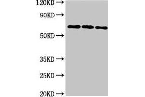 Western Blot Positive WB detected in: 293T whole cell lysate, Hela whole cell lysate, HepG2 whole cell lysate All lanes: NTN1 antibody at 6. (Netrin 1 antibody  (AA 186-478))