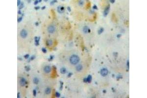 IHC-P analysis of Liver tissue, with DAB staining. (IL18RAP antibody  (AA 117-240))