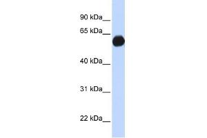 AKAP1 antibody used at 1 ug/ml to detect target protein.