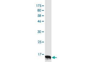 Western Blot detection against Immunogen (11. (CD137 antibody  (AA 46-128))