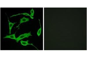 Immunofluorescence analysis of LOVO cells, using GPR85 Antibody. (GPR85 antibody  (AA 181-230))