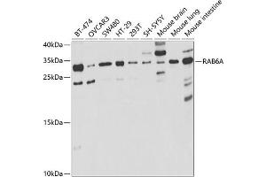 Western blot analysis of extracts of various cell lines, using RA antibody (ABIN6128604, ABIN6146602, ABIN6146604 and ABIN6221246) at 1:1000 dilution. (RAB6A antibody  (AA 1-200))