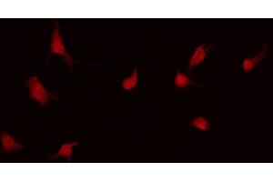 ABIN6268978 staining Hela by IF/ICC. (LCK antibody  (pSer59))