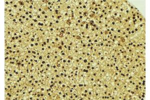 ABIN6277058 at 1/100 staining Mouse liver tissue by IHC-P.
