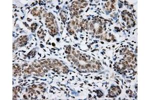 Immunohistochemical staining of paraffin-embedded breast tissue using anti-SHC1 mouse monoclonal antibody.