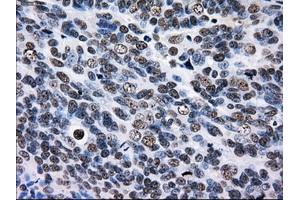 Immunohistochemical staining of paraffin-embedded Kidney tissue using anti-RPA2 mouse monoclonal antibody. (RPA2 antibody)