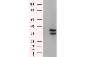 HEK293T cells were transfected with the pCMV6-ENTRY control (Left lane) or pCMV6-ENTRY DAPK2 (Right lane) cDNA for 48 hrs and lysed. (DAPK2 antibody)