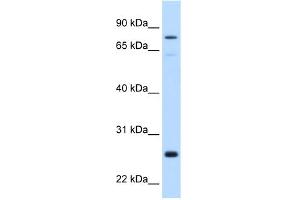 WB Suggested Anti-GSTM2 Antibody Titration:  0.