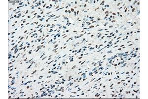 Immunohistochemical staining of paraffin-embedded colon tissue using anti-STK3mouse monoclonal antibody. (STK3 antibody)