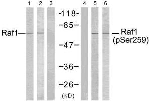 Western blot analysis using Raf-1 (Ab-259) antibody (E021006, Line 1, 2, and 3) and Raf-1 (phospho- Ser259) antibody (E011006, Line 4, 5, and 6). (RAF1 antibody  (pSer259))