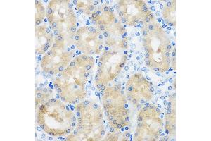 Immunohistochemistry of paraffin-embedded Rat kidney using C9orf114 Rabbit pAb (ABIN7266390) at dilution of 1:100 (40x lens). (C9orf114 antibody)