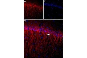 Expression of CACNB1 (CaVβ1) in rat hippocampus - Immunohistochemical staining of rat hippocampus using Anti-CACNB1 Antibody (ABIN7042984, ABIN7044049 and ABIN7044050).