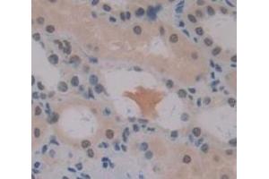 IHC-P analysis of Human Tissue, with DAB staining. (PRAME antibody  (AA 416-502))