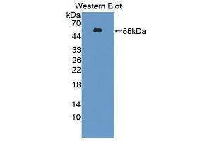 Western Blotting (WB) image for anti-Hepatitis A Virus Cellular Receptor 1 (HAVCR1) (AA 21-245) antibody (ABIN1859535) (HAVCR1 antibody  (AA 21-245))